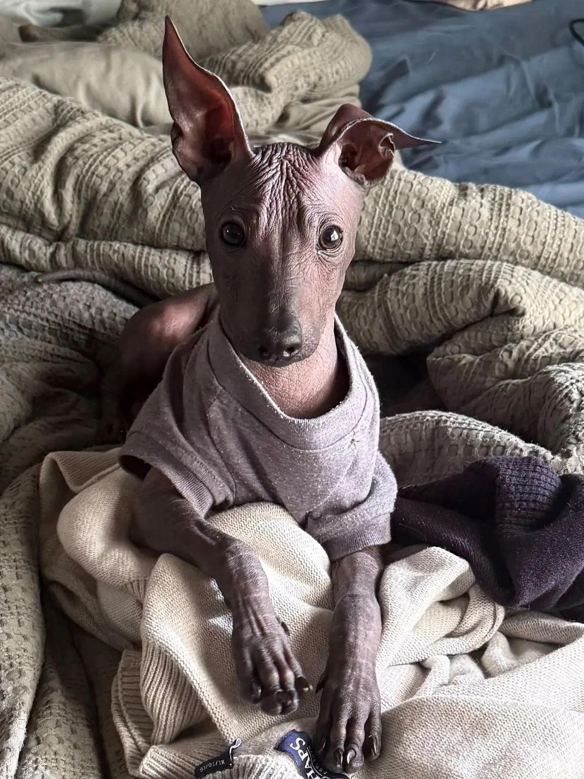 Onix Ramírez con una camiseta gris, recostado entre cobijas en su hogar