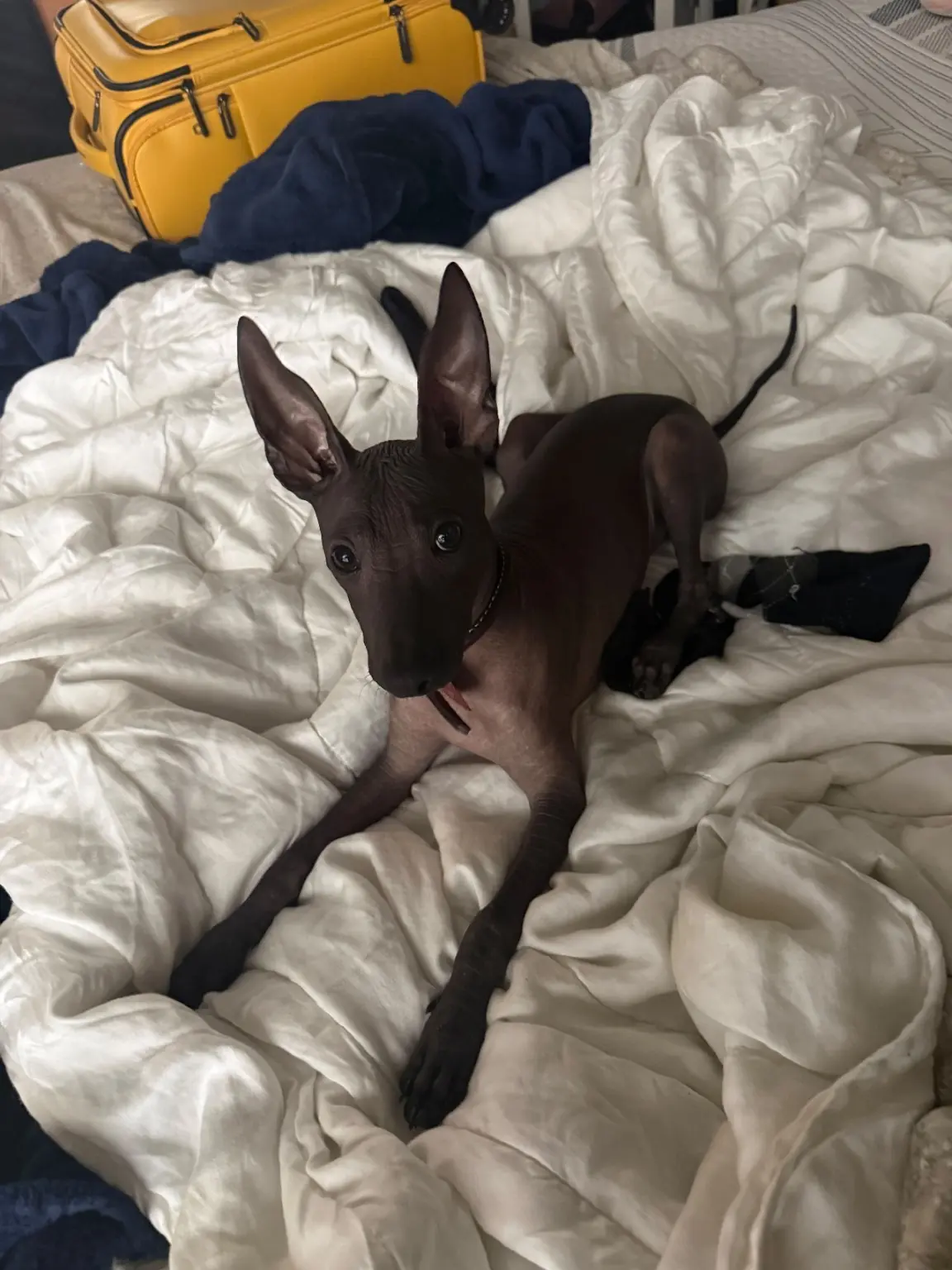 Onix Ramírez recostado sobre una cama en su hogar